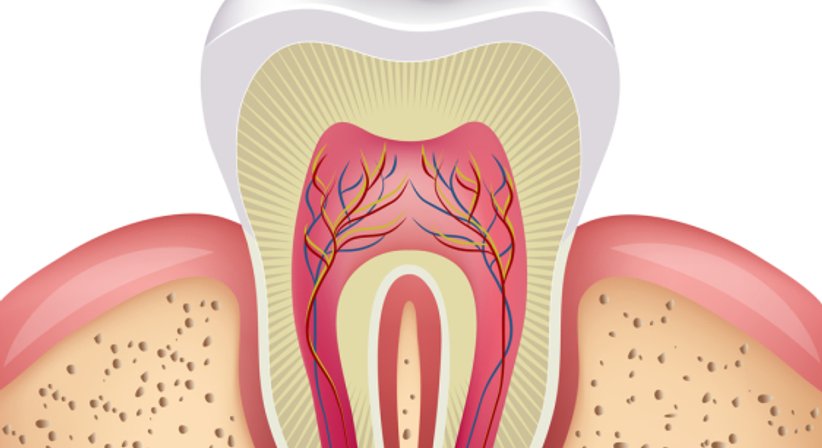 Wurzelbehandlung - Dr. Stefan Schragl - Zahnarzt Neunkirchen 2620