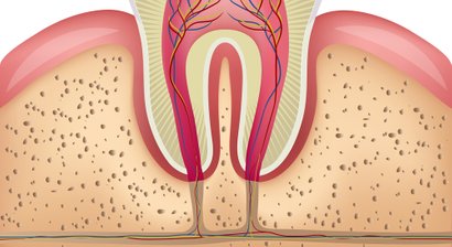 Mikroskopische Wurzelbehandlung (Endodontie)/Revision einer Wurzelbehandlung (erneute Wurzelbehandlung)