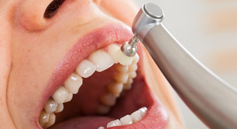 Professionelle Mundhygiene (Prophylaxe) - Dr. med. dent. Kremena Malinova - Zahnärztin Wien 1060