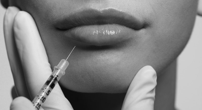 Hyaluronsäure - Dr. Julia Cordin - Plastische Chirurgin Mieming 6414