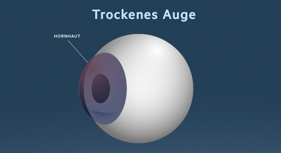 Trockenes Auge
