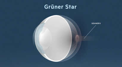 Grüner Star (Glaukom)