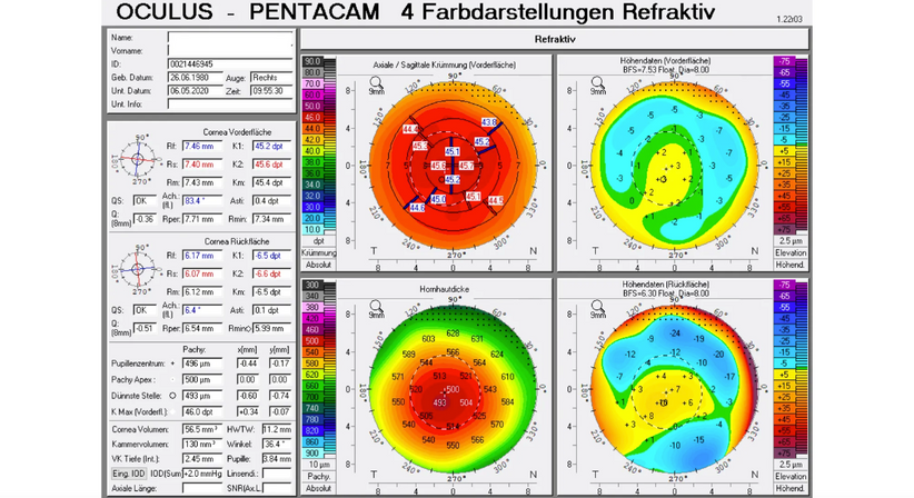 Hornhaut-Erkrankungen - Prof. Dr. Martin Dirisamer, FEBO - Augenarzt Wien 1010