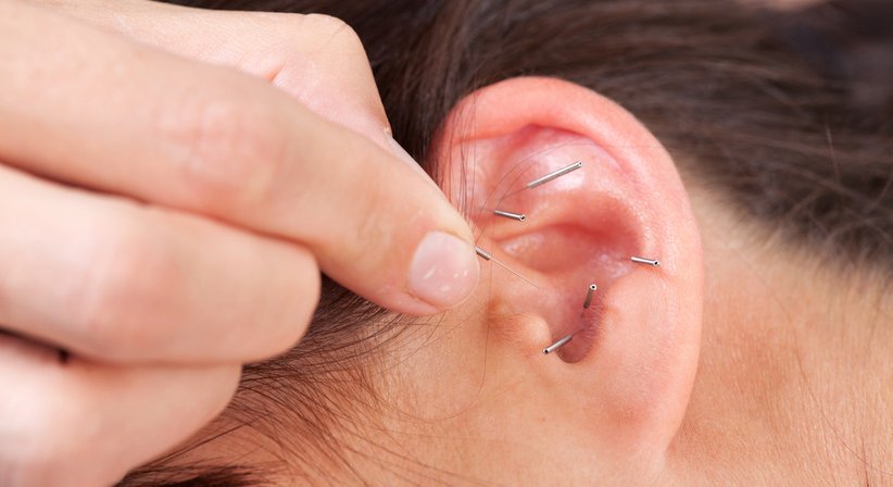 Ohr-Akupunktur - Dr. Gregor Timmel - Praktischer Arzt Wien 1070