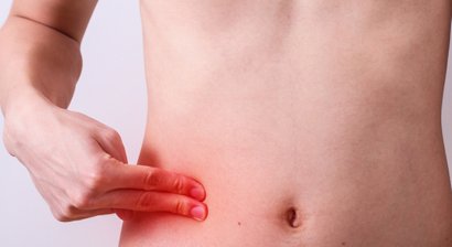 Blinddarmentzündung, Appendicitis