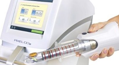 FemiLift Laser zur Vaginalstraffung, gegen Stressinkontinenz