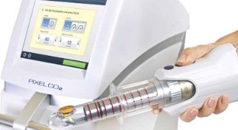 FemiLift Laser zur Vaginalstraffung, gegen Stressinkontinenz - OA Dr. Frank Marschall - Allgemeinchirurg/Viszeralchirurg Wien 1090