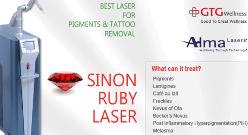 Tattoo entfernen, Pigmentflecken entfernen, sanft weglasern - OA Dr. Frank Marschall - Allgemeinchirurg/Viszeralchirurg Wien 1090