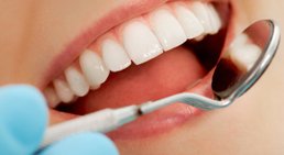 Parodontale Prophylaxe -