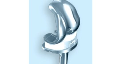 Knieprothese (Kniearthrose/ Gonarthrose)