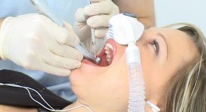 Angstfrei mit Lachgassedierung