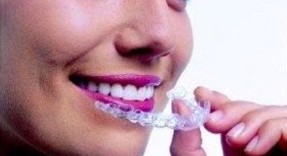 Unsichtbare Zahnregulierung / Invisalign