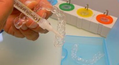 Zähne aufhellen / Bleaching