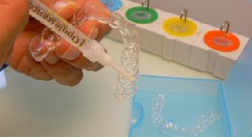 Zähne aufhellen / Bleaching - Dr. Erik Thaller - Zahnarzt Wien 1050