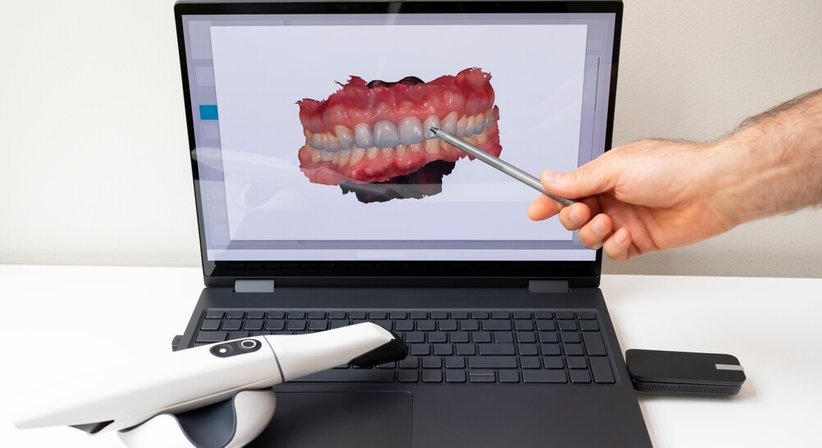 Digitale Zahnheilkunde - Dr. Gustav Niebauer - Zahnarzt Wien 1100