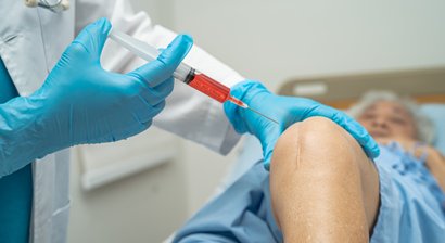 Hyalurontherapie bei gering- bis mittelgradigem Gelenkverschleiß und als Kombinationstherapie zur Stammzelltherapie