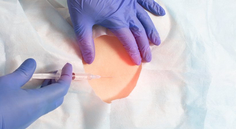 Röntgengestützte Infiltrationen - Dr. Oktawian Ilow - Orthopäde Kirchberg am Wagram 3470