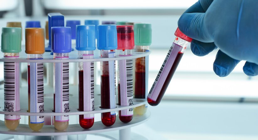 Labordiagnostik - OÄ Dr. med. univ. Marion Ljuba - Kardiologin Klagenfurt 9020