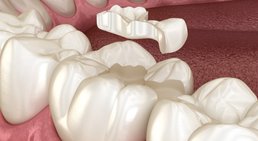 Dr. Günther Schuster - Zahnarzt Wien 1140