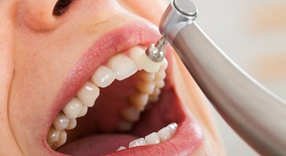 Prophylaxe / Professionelle Mundhygiene