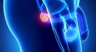 Erkrankungen der Prostata