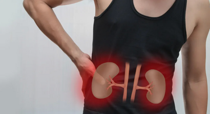 Nieren- und Harnleitersteine