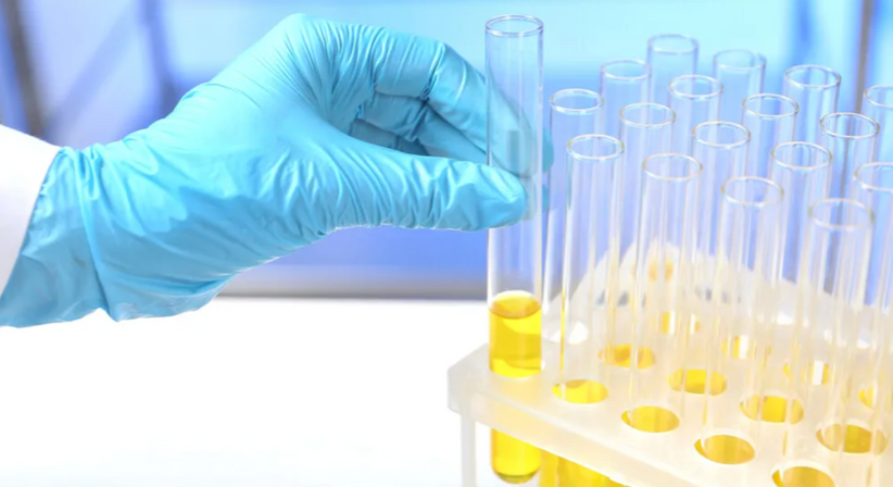 Urologische Vorsorgeuntersuchung - OA Dr. Kadir Tosun - Urologe Wien 1110