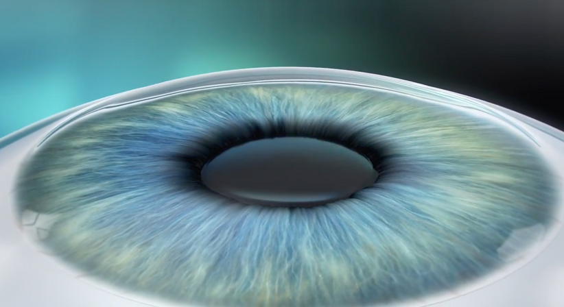 ICL (Implantierbare Collamer Linse) - Dr. Dino Dolib - Augenarzt Wien 1010