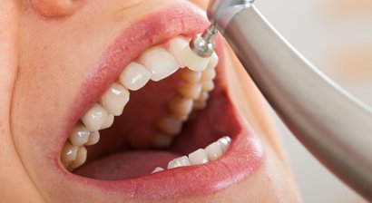 Prophylaxe/Mundhygiene 