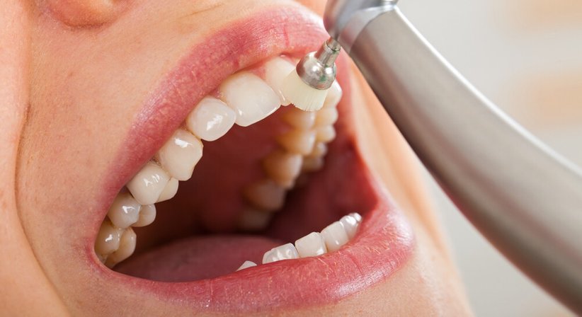 Prophylaxe/Mundhygiene  - DDr. Carina Dirisamer - Zahnärztin Laakirchen 4663