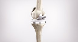 Dr. Wolfgang Freilinger, LL.M. - Orthopäde Wien 1140