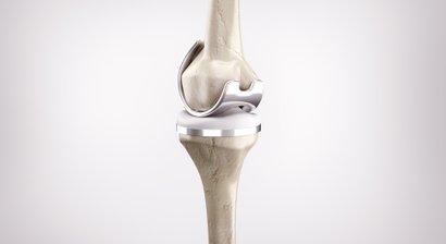 Knieprothese