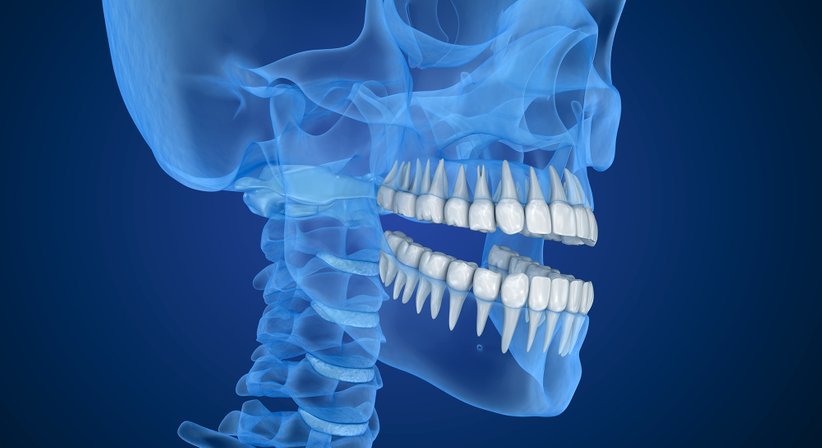 3D Röntgen in unserer Zahnarztpraxis - Dr. Pastorel Gorea - Zahnarzt Wien 1100