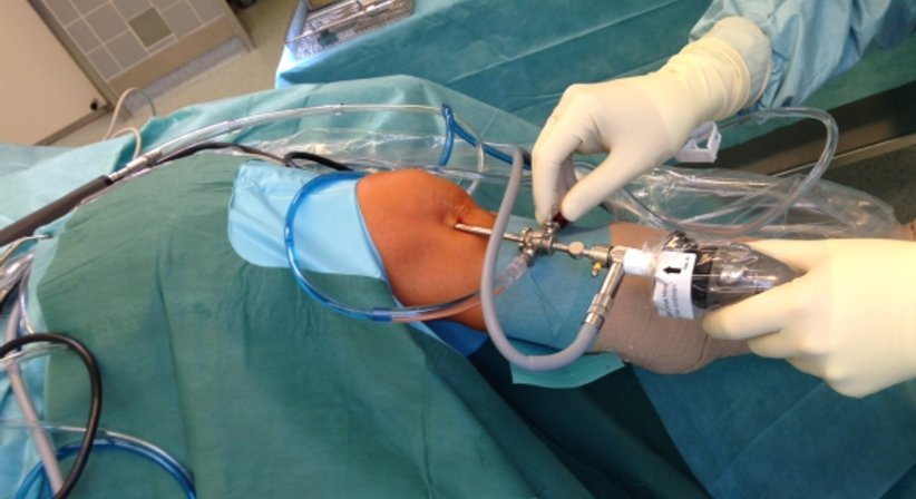 Arthroskopie - Priv.-Doz. Dr. Patrick Weninger - Unfallchirurg Wien 1010