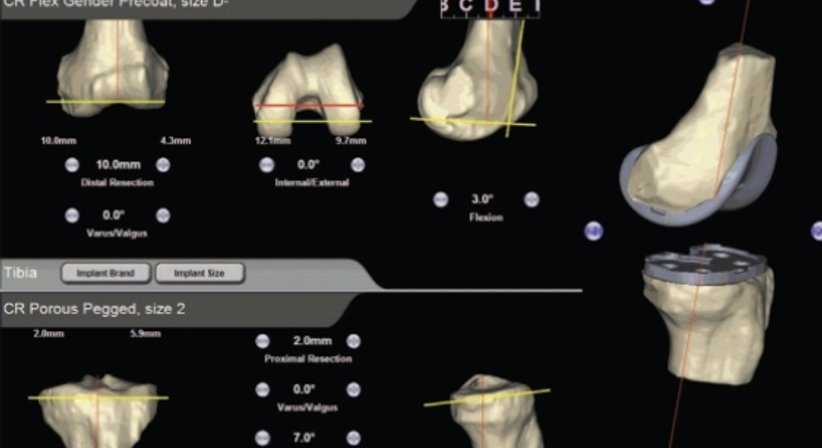 Knie - Doz. Dr. Jochen Hofstätter - Orthopäde St. Pölten 3100