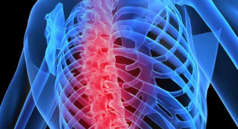 Wirbelsäule - Doz. Dr. Jochen Hofstätter - Orthopäde St. Pölten 3100