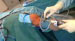 Arthroskopie -