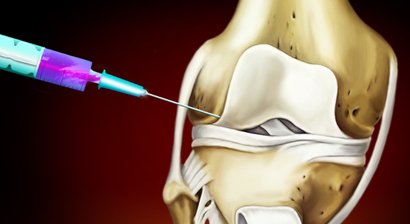 Orthopädische Schmerztherapie