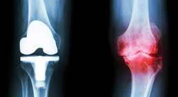 Univ. Prof. Dr. Ronald Dorotka - Orthopäde Wien 1010