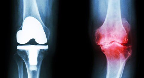 Univ. Prof. Dr. Ronald Dorotka - Orthopäde Wien 1010