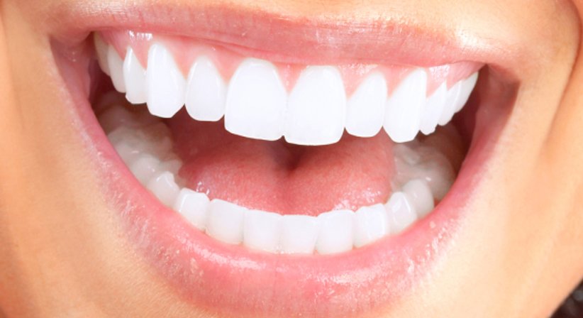 Zahnersatz aus Keramik - Dr. Wolfgang Burger - Zahnarzt Feldkirch 6800