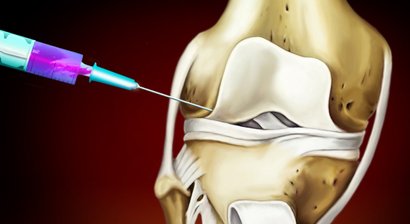 Orthopädische Schmerztherapie