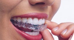 Kieferorthopädie und Invisalign -