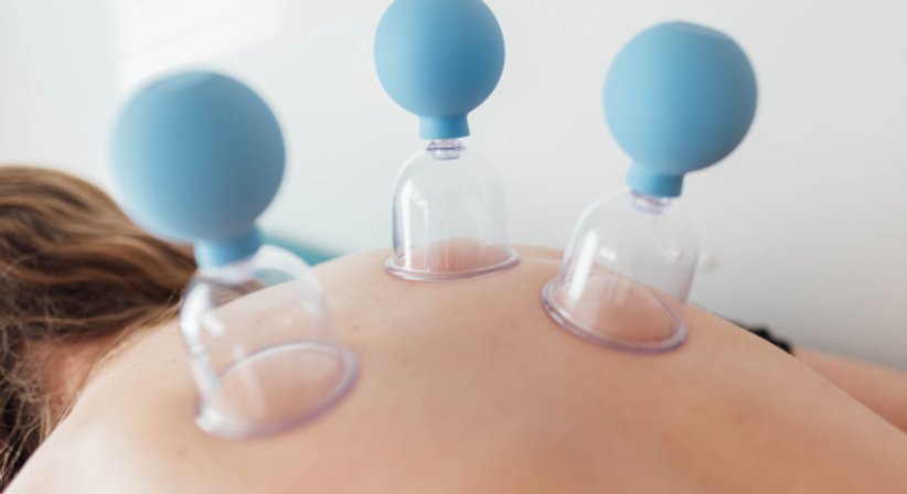 Schröpfen/Schröpftherapie - Dr. Kambiz Modarressy - Praktischer Arzt Wien 1120