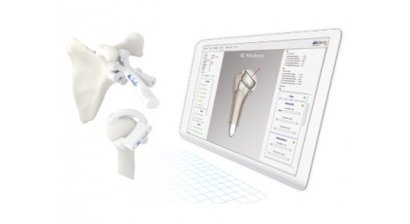 Arthrose / cumputergestützte Schulterprothese im 3D Druck
