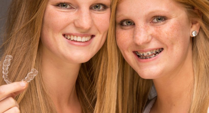 Festsitzende Zahnspange - Dr. med. dent. Guido Sampermans - Zahnarzt Wien 1140