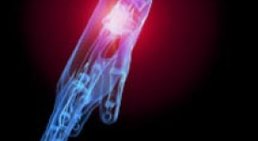 Doz. Dr. Jochen Hofstätter - Orthopäde Wien 1080