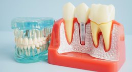 Dr. med. dent. Arnold Bobb - Zahnarzt Wien 1020