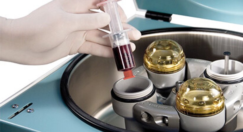 ACP/PRP Therapie (Eigenbluttherapie) - OÄ Dr. med. univ. Sylvia Ebm - Orthopädin Wien 1020