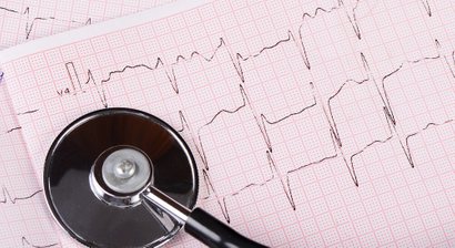 EKG (Elektrokardiografie)